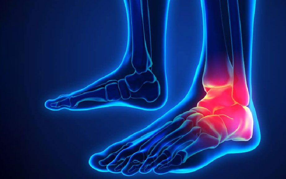 Artroskopik (Kapalı) Ayak Bileği