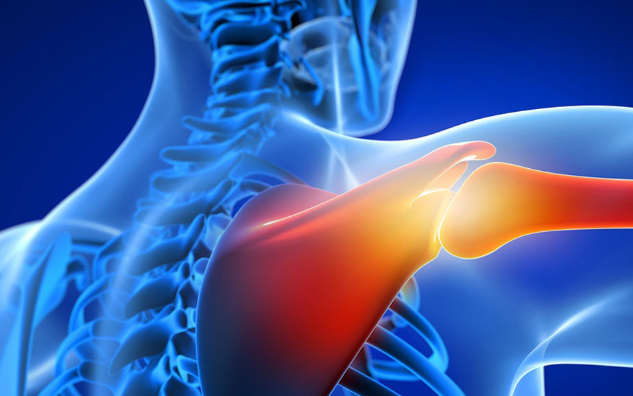 Artroskopik (Kapalı) Omuz 